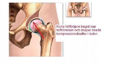 komprhöft