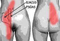 psoa